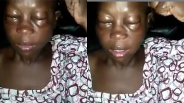 Man beats wife to a pulp for allegedly starting a business against his wish
