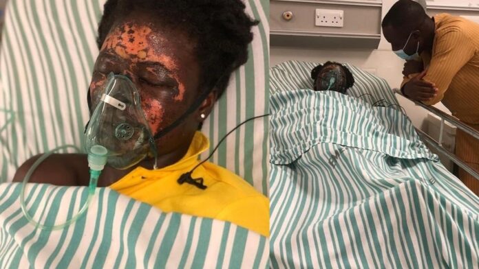 Man allegedly bathes his wife with acid in Ghana.