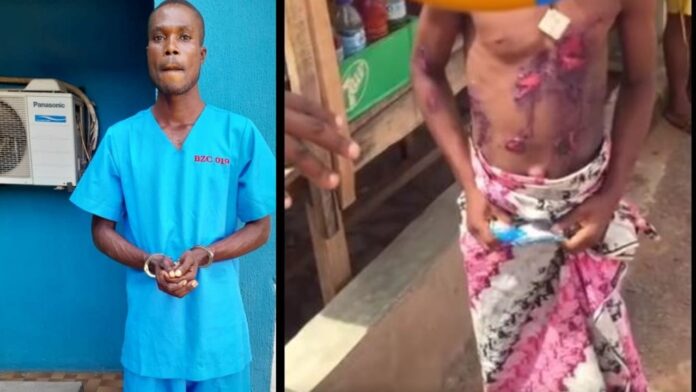 Nigerian Man arrested for allegedly torturing his stepson with hot knife over N20 theft