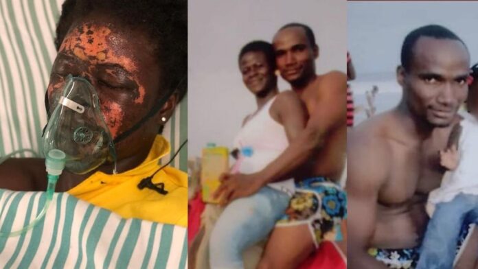 Ghanaian man sentenced to 10 years in prison for pouring acid on wife