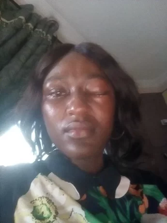 “I shall not die before my time” – Nigerian woman cries out after husband allegedly battered her