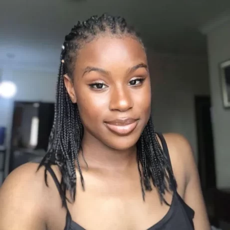 "I Never underwent any Surgery"- Burn writes as shows off her amazing transformation as skin heals without blemish; Reveals what she used(photos)